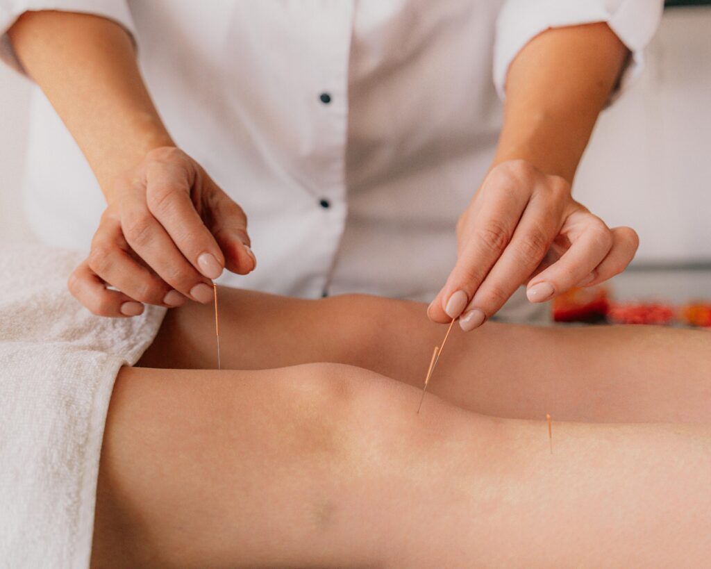 Acupuncture treatment on lower leg to support vagus nerve and gut health