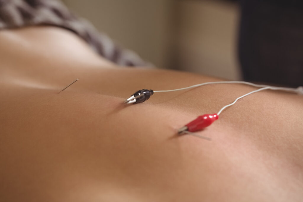 Acupuncture treatment for male fertility at Austin Transformational Health