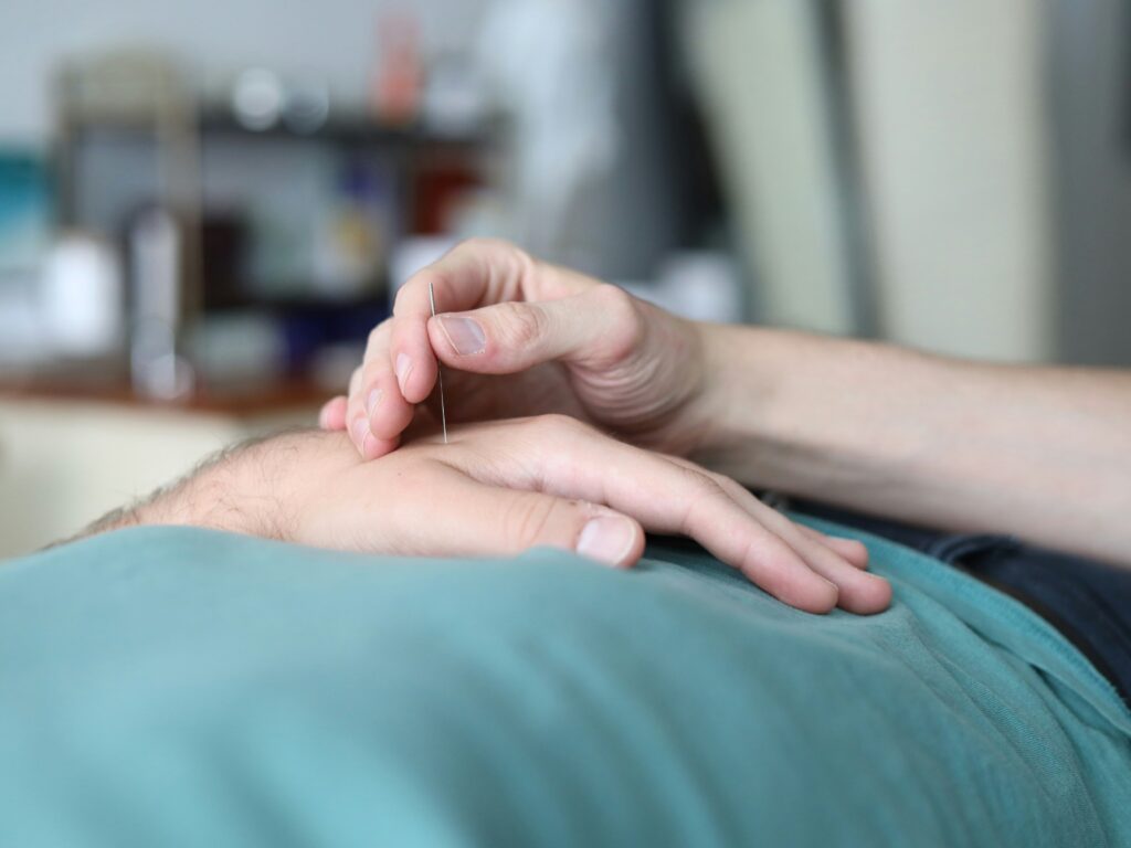 Acupuncture treatment session at Austin Transformational Health supporting neurological and digestive health