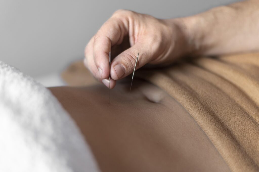Acupuncture treatment for reproductive health and ovarian reserve support