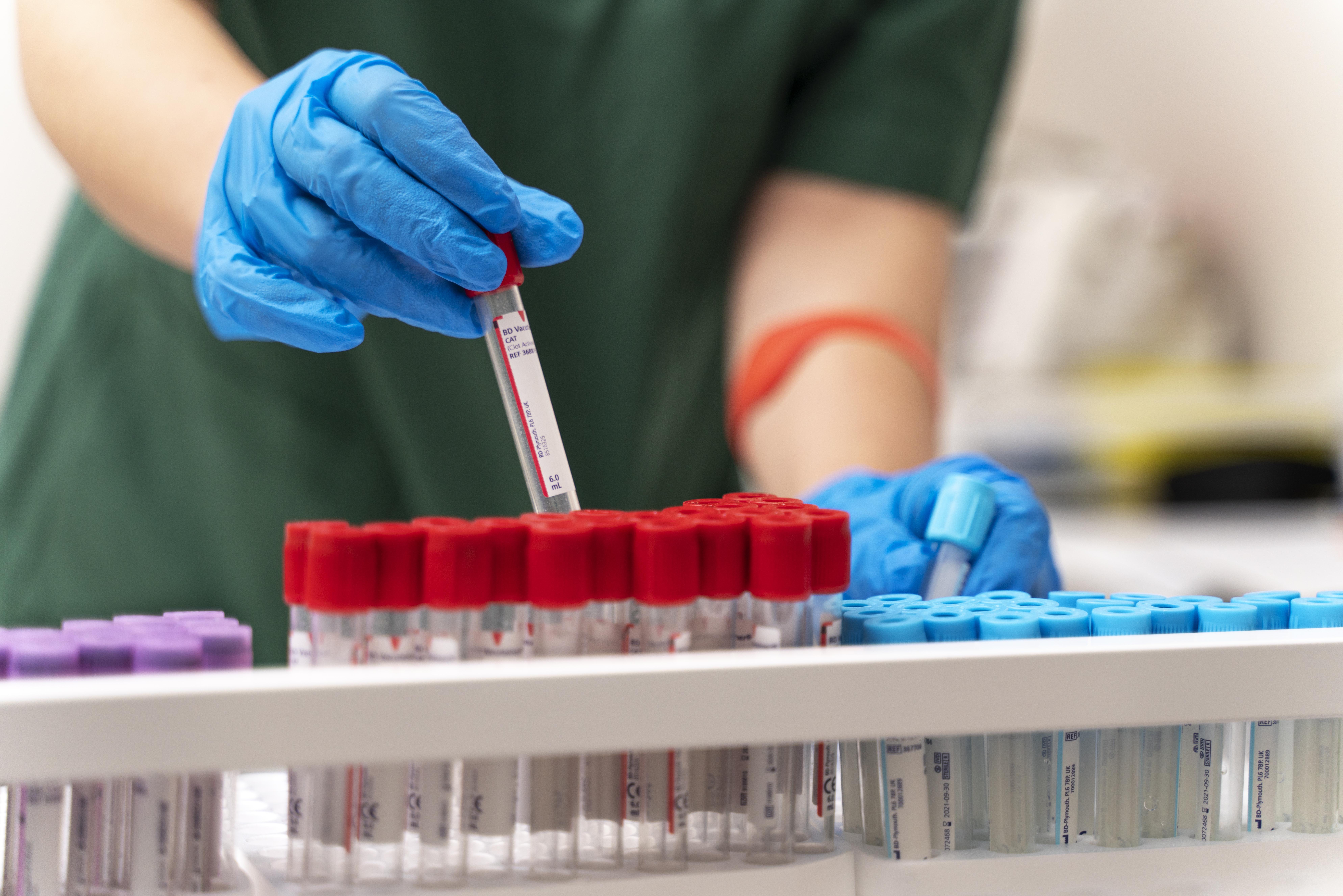 Lab testing vials representing IgG allergen panel testing for mold sensitivity