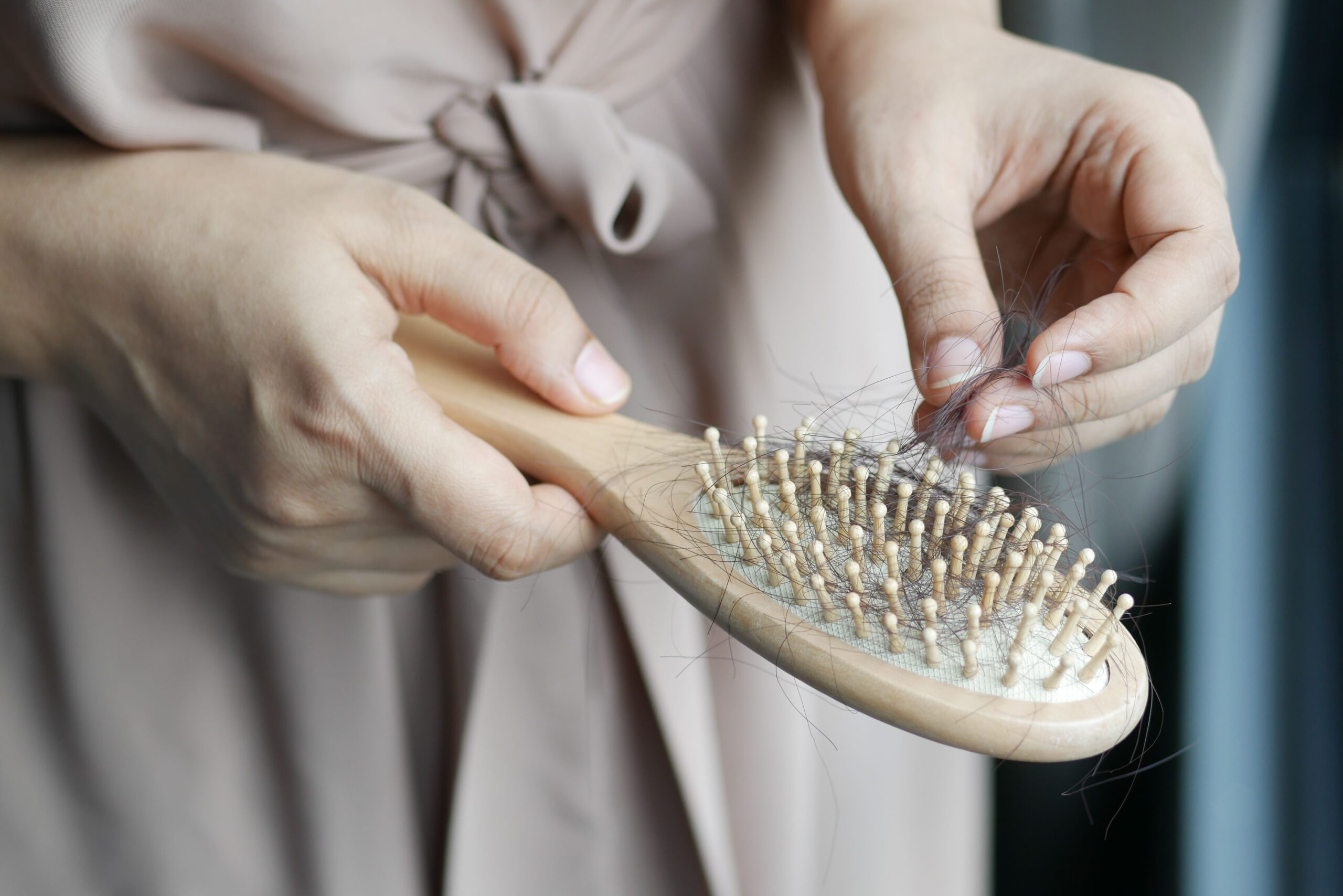 Person concerned about hair loss noticing more shedding than usual