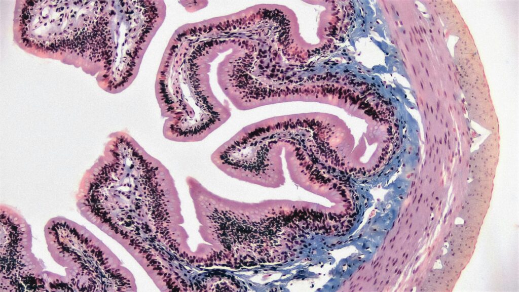 Illustration of the gut lining with immune cells and antibodies